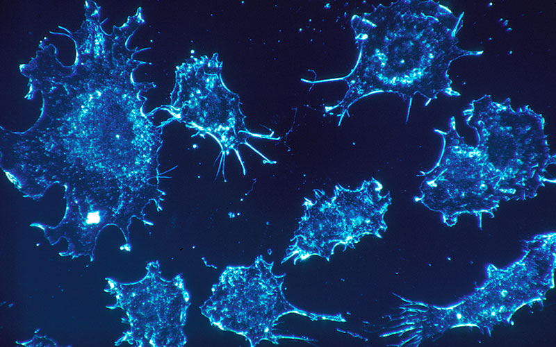 Cancer Cells from Wikimedia Commons